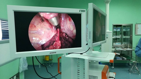 醫(yī)用高灰階監(jiān)視器分辨率是多少